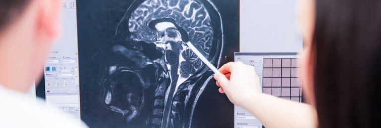 two doctors looking at scan of a brain