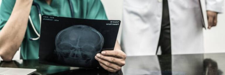Doctors reviewing a patient's x-ray results